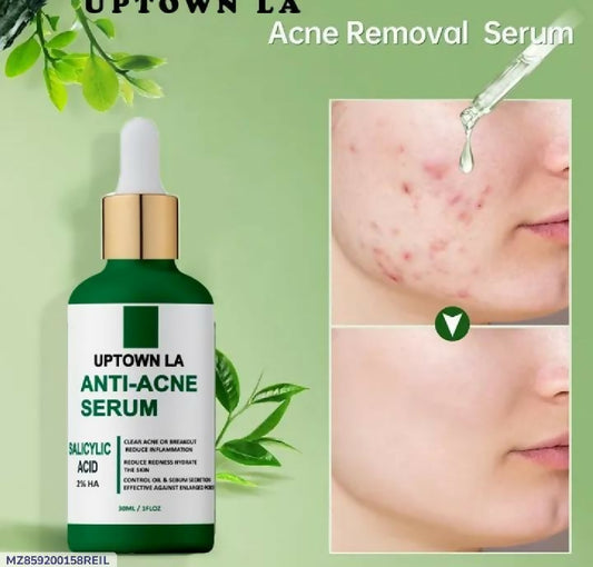 Uptown LA Anti Acne Serum for Face Clear Smooth and Healthy Skin Care
