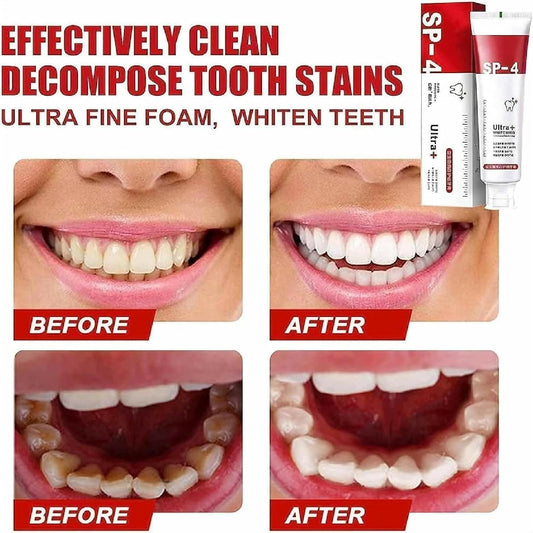 Yayashi Sp-4 Ultra Whitening Toothpaste Probiotic Stain Remover - Protects Gums and Freshens Breath - For Everyone