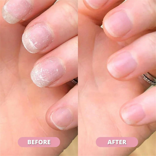 Nail-Growth-Cuticle-Oil-Pen-Radiant-Serum-Nutrient-Pen-for-Moisturizing-Strengthening-Brightening-Nails