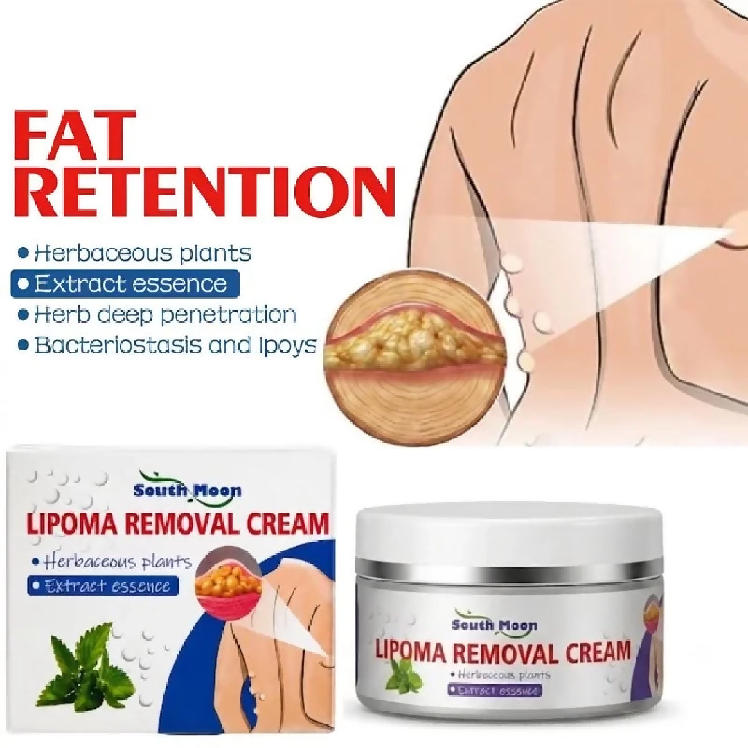 Lipoma Removal Cream Herbal Skin Care Cream for Smooth Nourished Skin Fast Absorbing Formula For Neck Body 50g