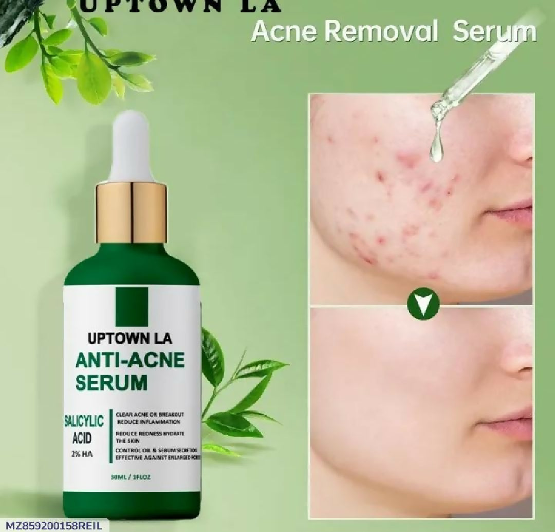 Uptown LA Anti Acne Serum for Face Clear Smooth and Healthy Skin Care