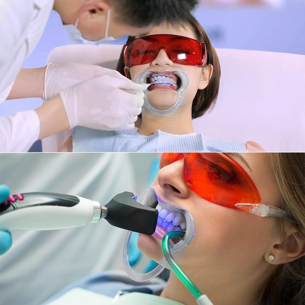 Dental Mouth Opener  C Shape Cheek Retractor for Dental Exams and Whitening