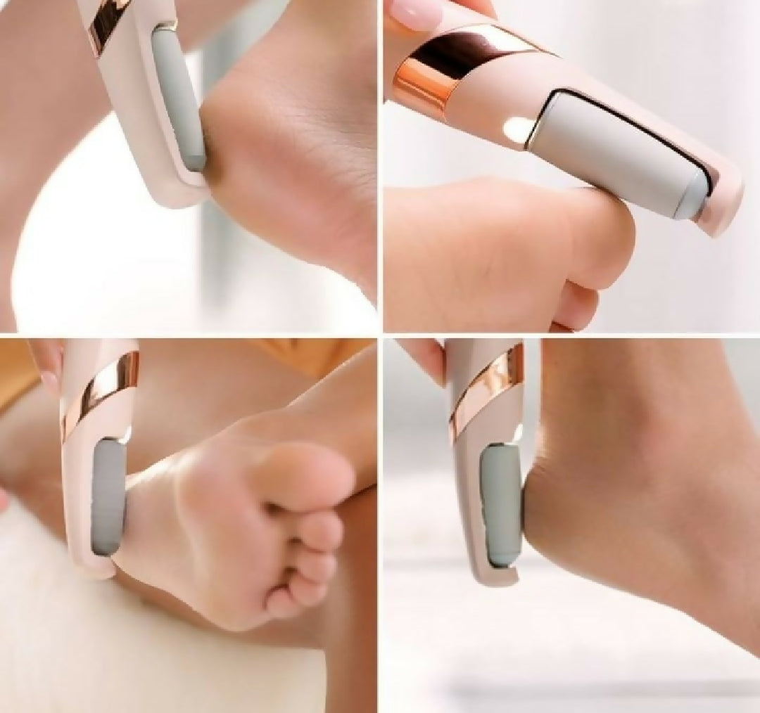 Rechargeable Electric Pedi Foot Filer – Powerful Callus Remover for Cracked Heels and Dead Skin Smooth Soft and Salon Quality Feet at Home