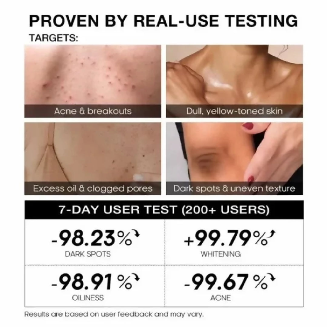 TeaShell Niacinamide Skin Brightening Soap Face Body Brightening Bar with Niacinamide Alpha Arbutin Tranexamic Acid Deep Cleansing Formula For Men Women 100g