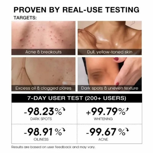 TeaShell Niacinamide Skin Brightening Soap Face Body Brightening Bar with Niacinamide Alpha Arbutin Tranexamic Acid Deep Cleansing Formula For Men Women 100g