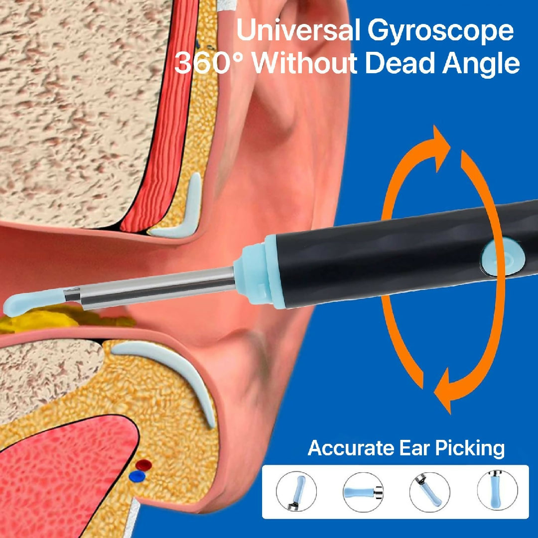 Rechargeable Smart Wireless Ear Camera Kit Visual Ear Wax Removal Tool With Mobile Display Random Colour