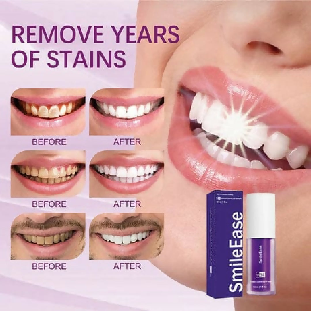 Teeth Brightening Hismiles V34 Colour Corrector Serum - 30ml - Hismile For Teeth Brightening