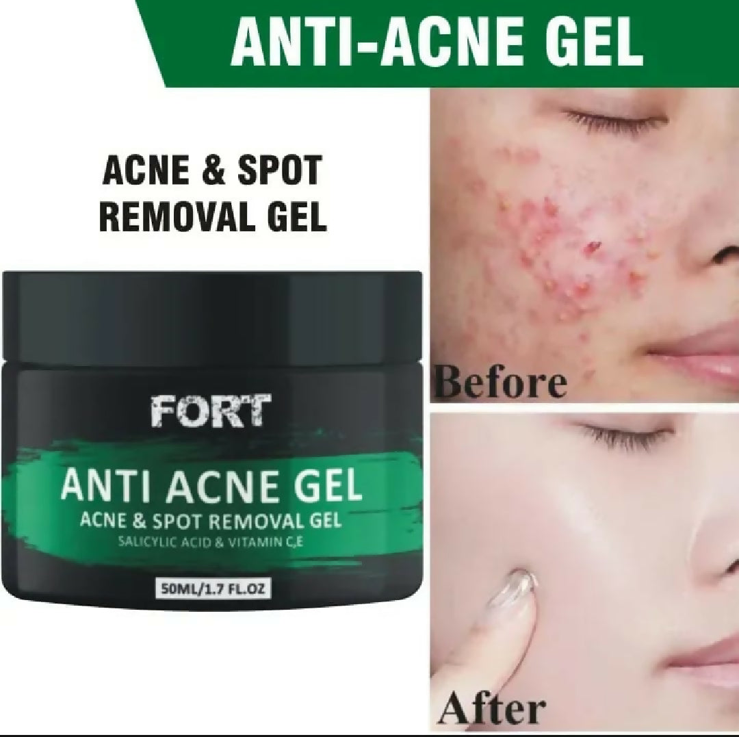 FORT Anti Acne Gel For Face Oil Control Acne Removal Clear Smooth Healthy Skin Care