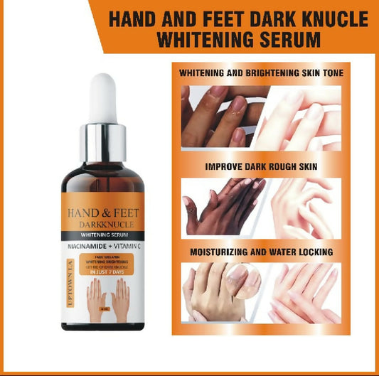 Uptown LA Hand and Feet Dark Nuckle Whitening Cream for Bright Smooth and Moisturized Skin Care