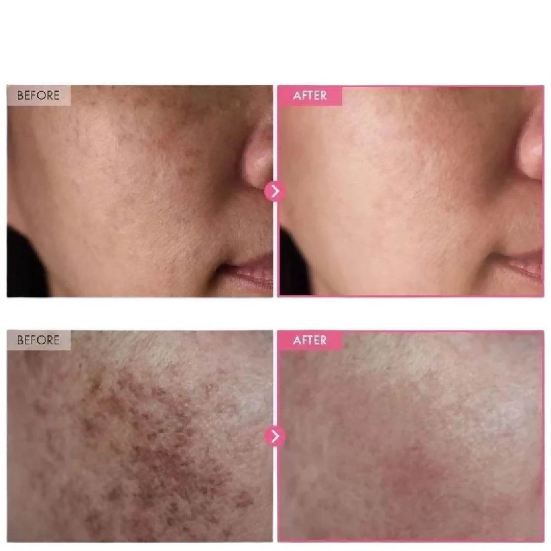 Arbutin 7 Percent Tranexamic Acid 4 Percent Cream Brightening Moisturizer for Dark Spots Uneven Tone Hydration 50g