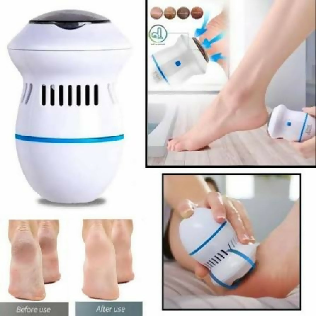 Electric Foot Grinder Dead Skin Remover Rechargeable