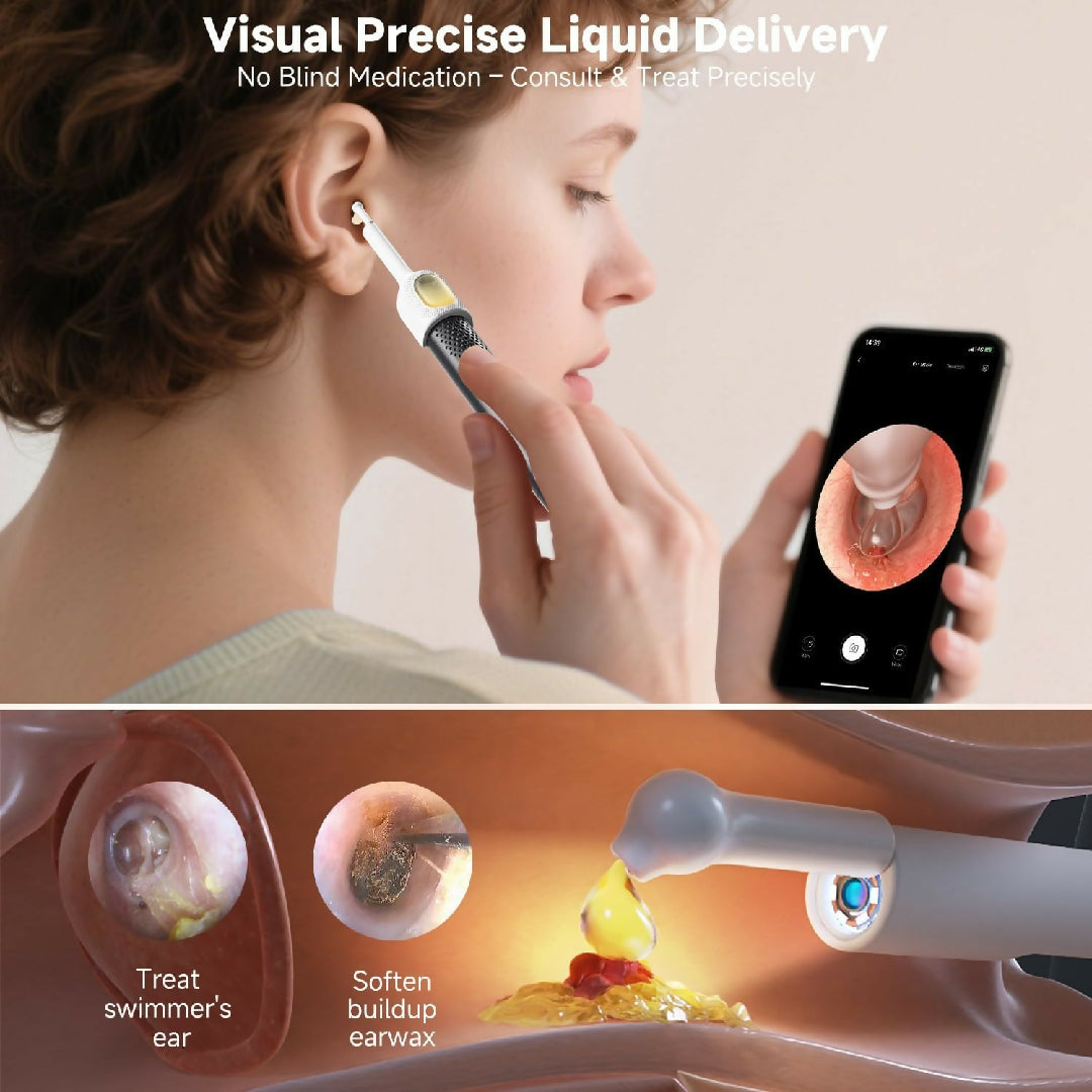 Rechargeable Smart Wireless Ear Camera Kit Visual Ear Wax Removal Tool With Mobile Display Random Colour