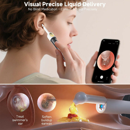 Rechargeable Smart Wireless Ear Camera Kit Visual Ear Wax Removal Tool With Mobile Display Random Colour