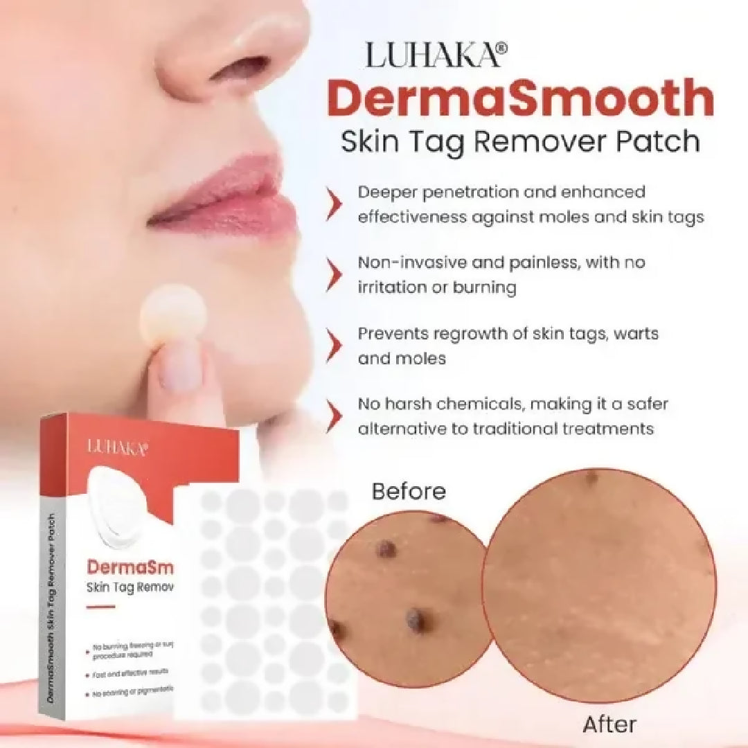 DermaSmooth Skin Tag Remover Patch - Fast Safe and Painless Skin Tag and Mole Removal Solution