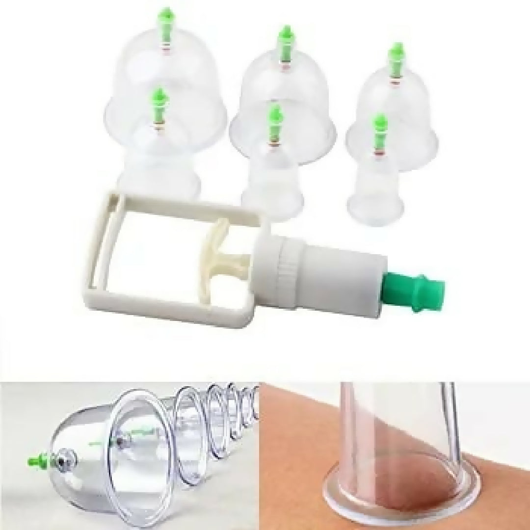 10-Piece Hijama Cupping Therapy Set Vacuum Suction Massage Cups with Pull-Out Pump Pain Relief Blood Circulation Relaxation Muscle Recovery Kit