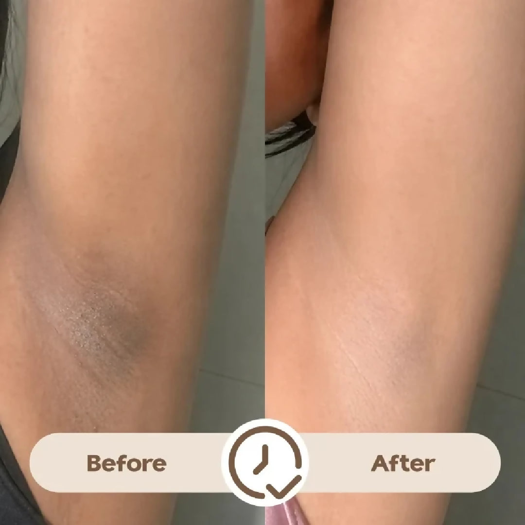 Ray Time To Shine Underarm Serum Brightening Underarm Serum with Niacinamide Alpha Arbutin Hyaluronic Acid Lightweight Daily Care 30ml