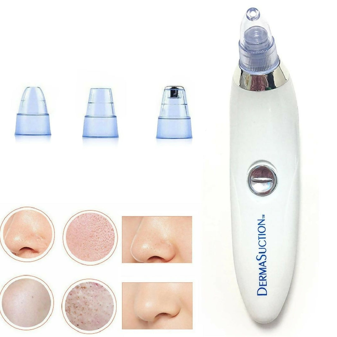 DermaSuction 4 in 1 Blackhead Remover
