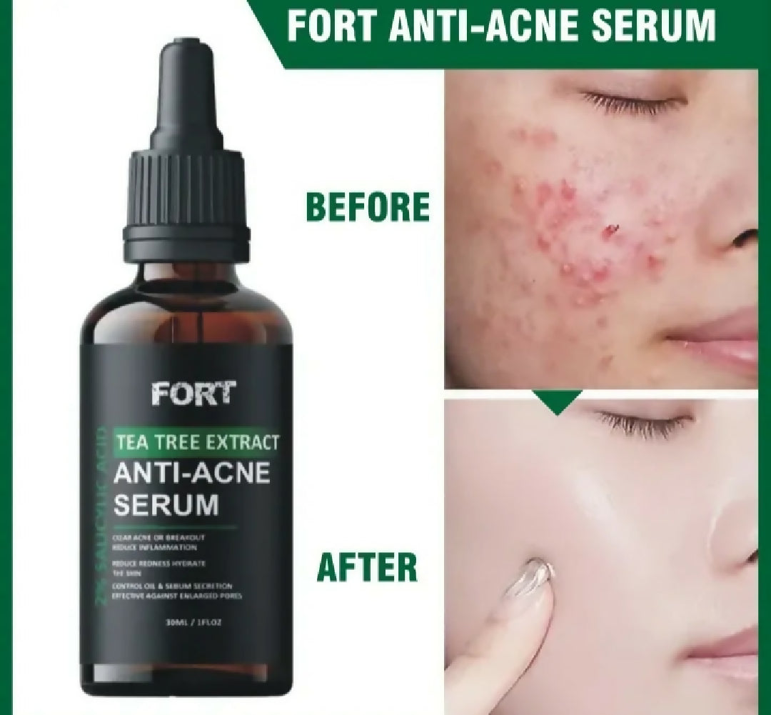 Uptwon LA Tea Tree Extract Anti Acne Serum for Clear Smooth and Healthy Skin Care