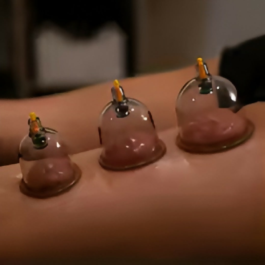 10-Piece Hijama Cupping Therapy Set Vacuum Suction Massage Cups with Pull-Out Pump Pain Relief Blood Circulation Relaxation Muscle Recovery Kit