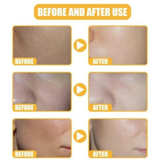 Uptwon LA Whitening Rice Serum for Face Brightening Hydrating and Smooth Skin Care