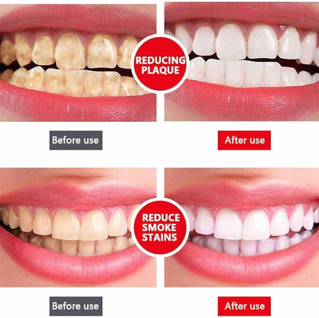 Yayashi Sp-4 Ultra Whitening Toothpaste Probiotic Stain Remover - Protects Gums and Freshens Breath - For Everyone