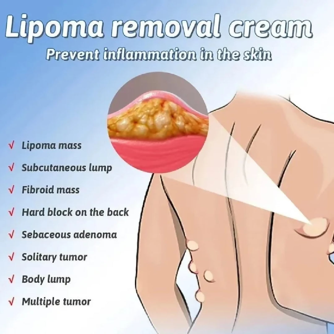 Lipoma Removal Cream Herbal Skin Care Cream for Smooth Nourished Skin Fast Absorbing Formula For Neck Body 50g