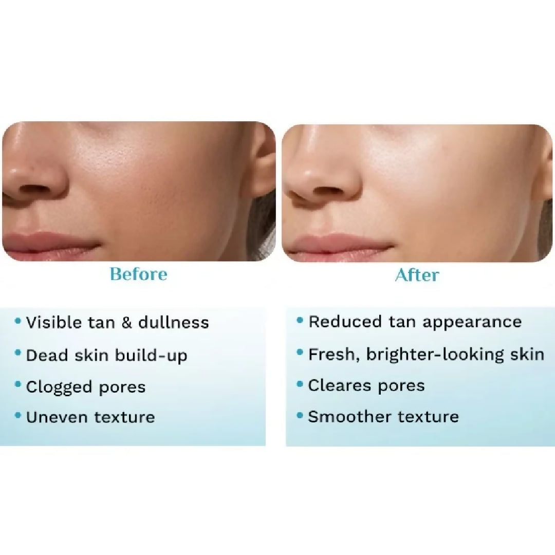 Pilgrim Peeling Solution Weekend Facial Peel for Deep Cleansing Exfoliation Radiant Even Toned Skin For Men Women 30ml