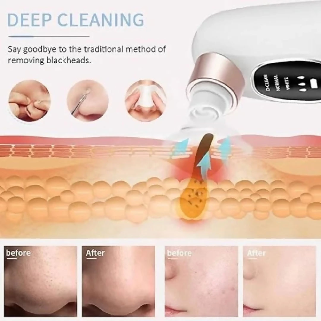 Electric Micro Bubble Beauty Blackhead Remover Pore Vacuum Cleaner Facial Deep Cleansing Device USB Rechargeable Skin Care Tool
