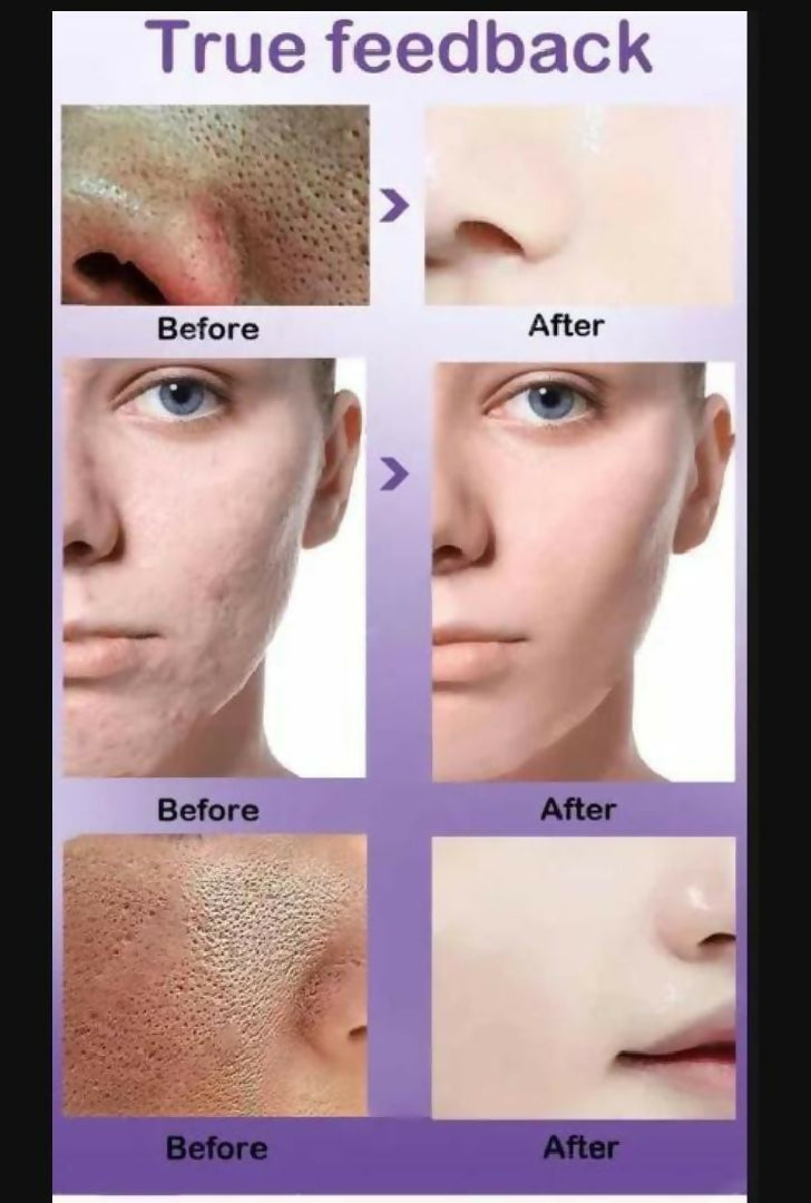 Uptown LA Pore Refining Serum for Face Smooth Bright and Healthy Skin Care
