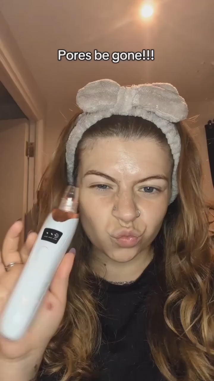 Blackhead Removal Machine Derma Suction 5 In 1 Black Head Remover Machine Acne Pimple Pore Cleaner Vacuum Tool Rechargeable Machine Oil Remover Multi-Functional Skin Care Tools Facial Beauty Device Whitehead Remover Deep face dust Cleaner