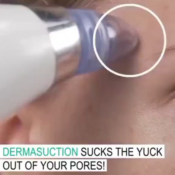 Multifunctional Electric Blackhead Remover