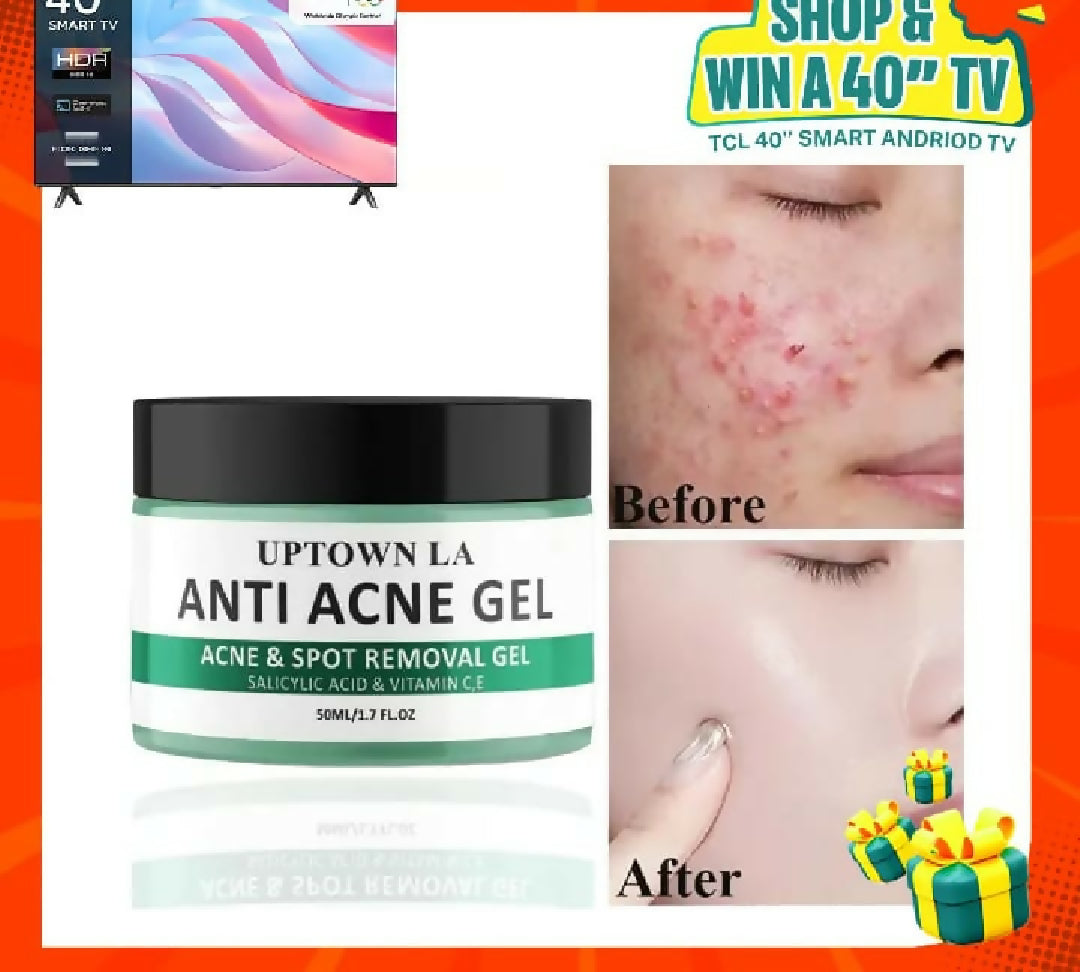 Uptown LA Anti Acne Gel For Face Oil Control Acne Treatment Clear Smooth Healthy Skin Care
