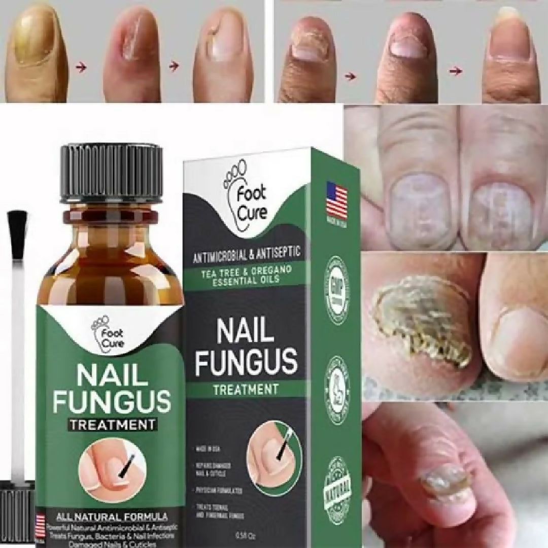 Nail Fungus Treatment Stop Fungal Growth Effective Fingernail 10ml