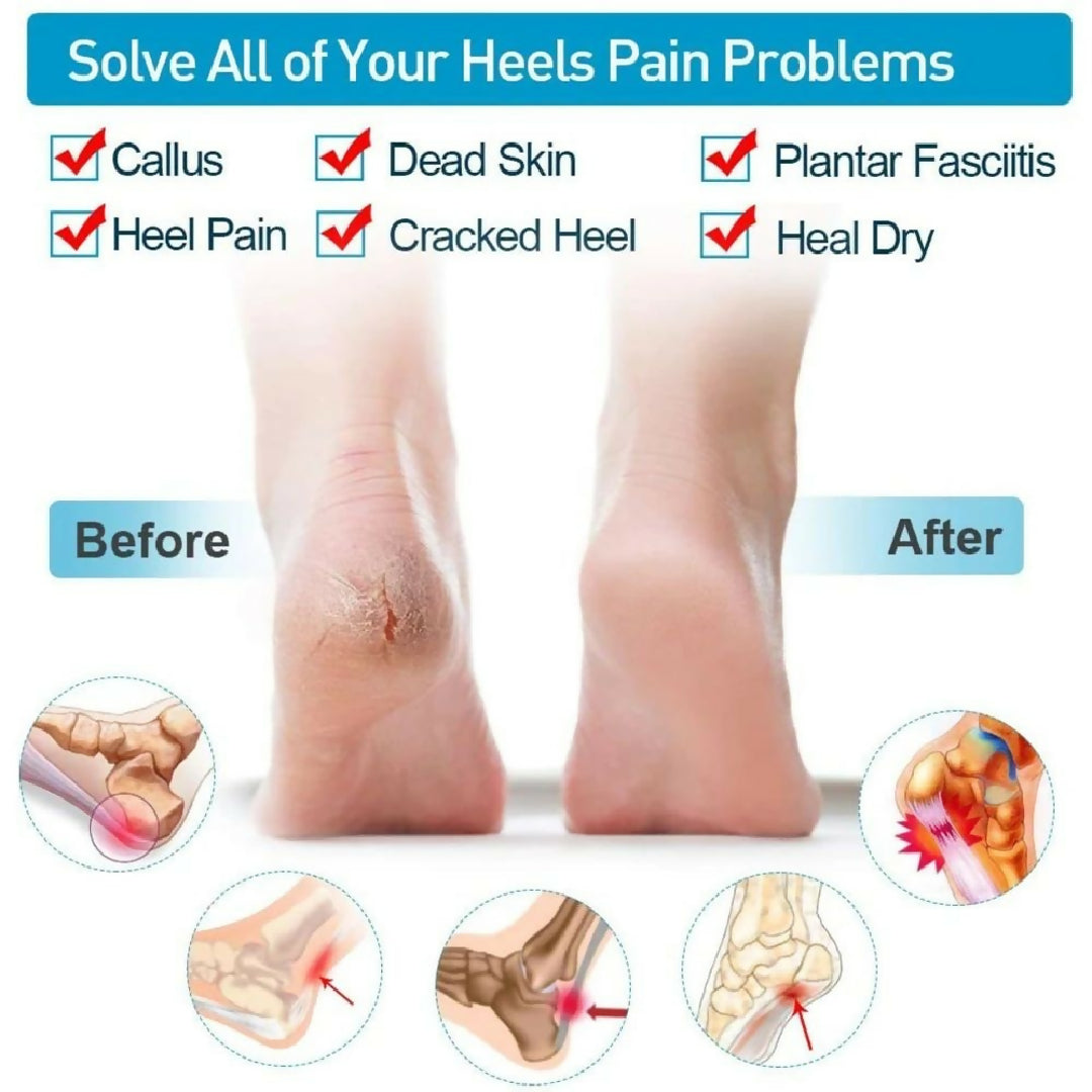 Silicone Heel Pads Anti Crack Heel Protector Heel Protectors Set Silicone Half Heel Anti Crack Covers Silicone Moisturizing Gel Heel Anti Crack Socks