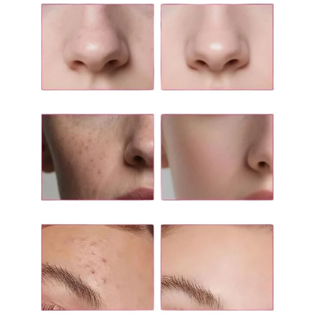 Arbutin 7 Percent Tranexamic Acid 4 Percent Cream Brightening Moisturizer for Dark Spots Uneven Tone Hydration 50g